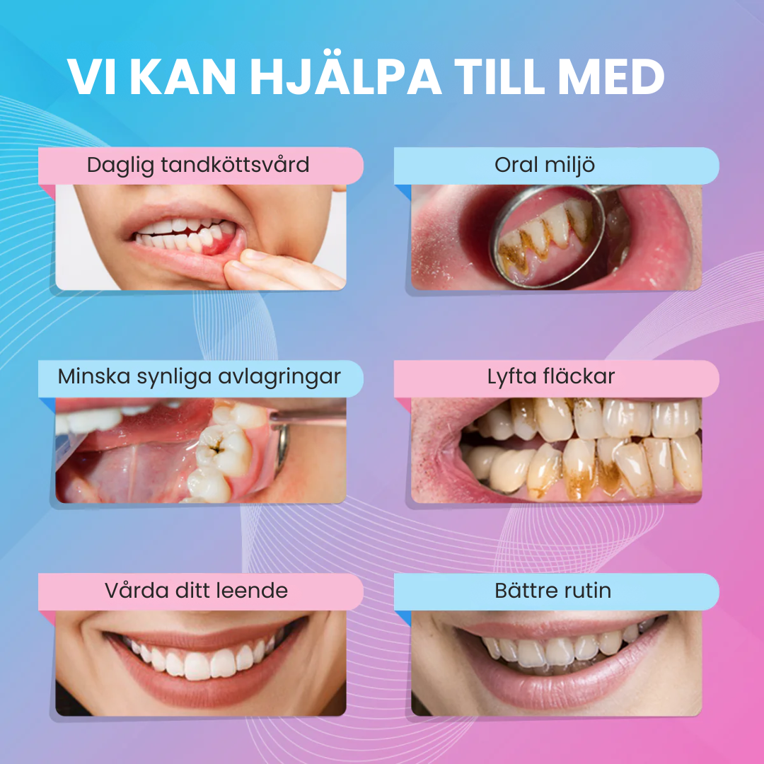 VivaClean - Glöm bort den dyra tandläkaren
