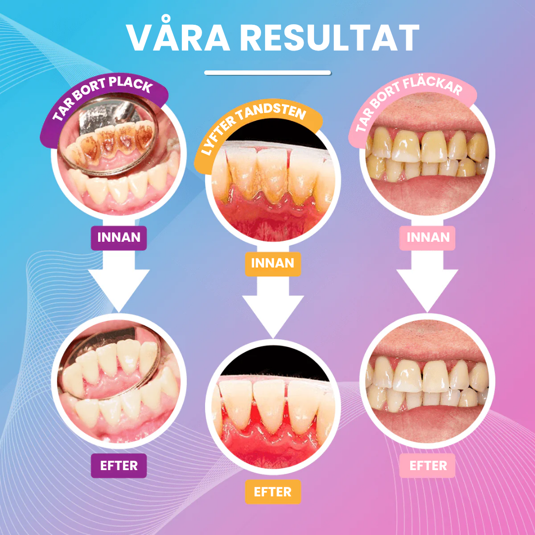 VivaClean - Glöm bort den dyra tandläkaren